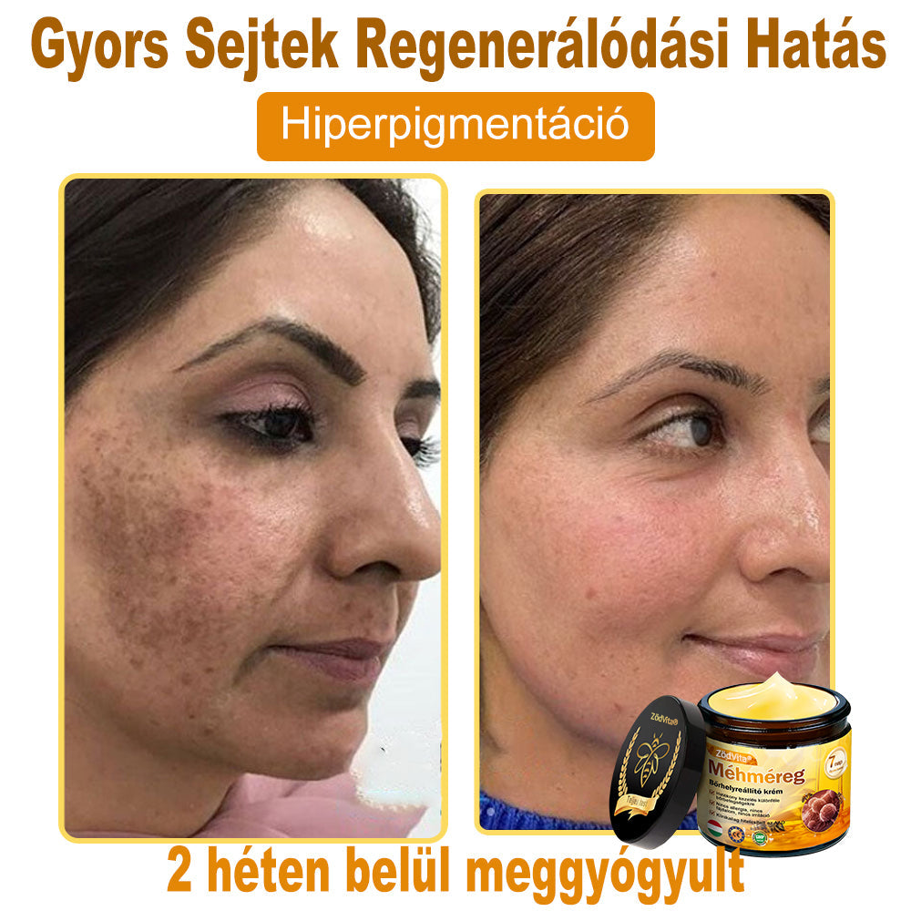 🌿Bőrgyógyász ajánlása ✨ ZödVita® Méhméreg Bőr Helyreállító Krém 🔥 Magyar fejlesztés, magyarországi gyártás és szállítás
