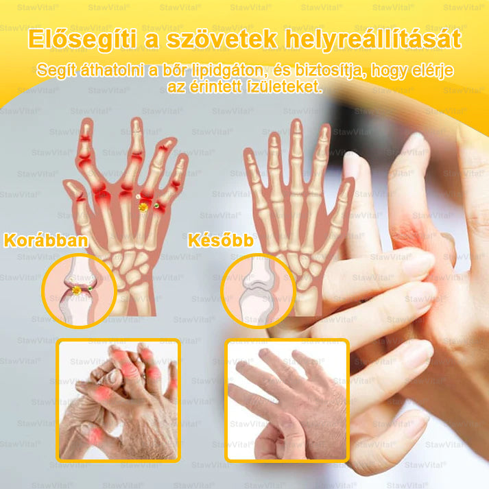 🟢𝑺𝒕𝒂𝒘𝑽𝒊𝒕𝒂𝒍® Botoxot és Méhmérget Tartalmazó Regeneráló Krém Ízületekre és Csontokra | MOT (Magyar Ortopéd Társaság) által tanúsított termék