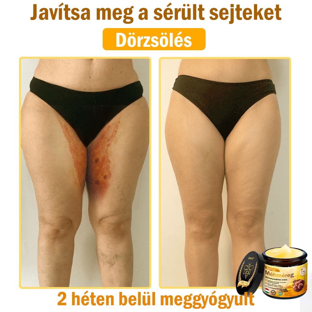 ✨✨Bőrgyógyász ajánlása ✨ ZödVita® Méhméreg Bőr Helyreállító Krém – Időskori purpura, ráncok és a bőr állapotának látványos javítása 💜 Magyar fejlesztés, magyarországi gyártás és szállítás