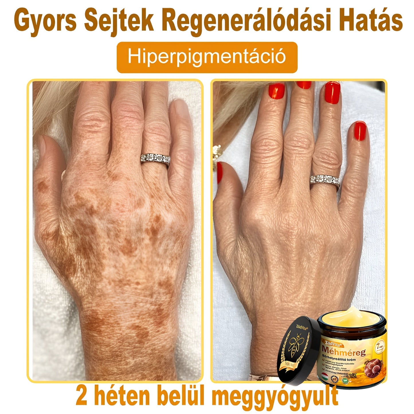 🌿Bőrgyógyász ajánlása ✨ ZödVita® Méhméreg Bőr Helyreállító Krém 🔥 Magyar fejlesztés, magyarországi gyártás és szállítás