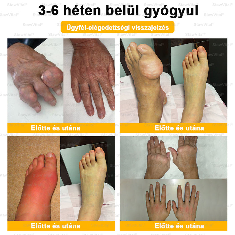 🟢𝑺𝒕𝒂𝒘𝑽𝒊𝒕𝒂𝒍® Botoxot és Méhmérget Tartalmazó Regeneráló Krém Ízületekre és Csontokra | MOT (Magyar Ortopéd Társaság) által tanúsított termék