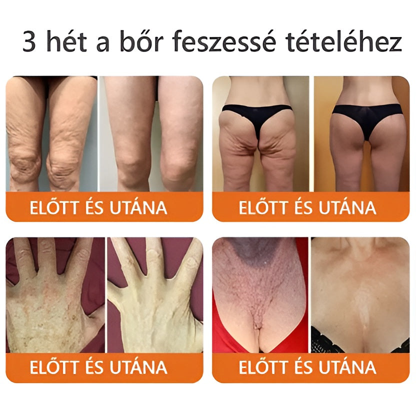 🌿Bőrgyógyász ajánlása ✨ ZödVita® Méhméreg Bőr Helyreállító Krém 🔥 Magyar fejlesztés, magyarországi gyártás és szállítás