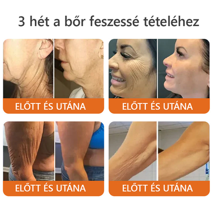 🌿Bőrgyógyász ajánlása ✨ ZödVita® Méhméreg Bőr Helyreállító Krém 🔥 Magyar fejlesztés, magyarországi gyártás és szállítás