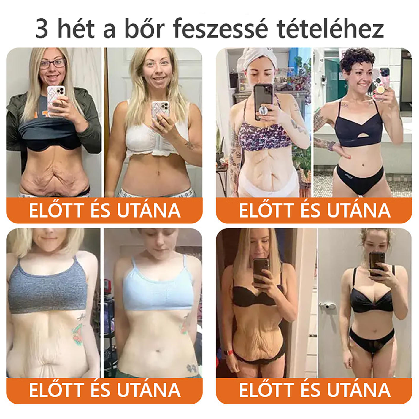 🌿Bőrgyógyász ajánlása ✨ ZödVita® Méhméreg Bőr Helyreállító Krém 🔥 Magyar fejlesztés, magyarországi gyártás és szállítás