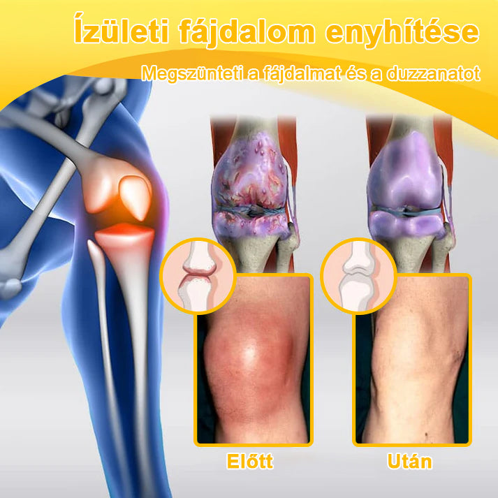 🟢𝑺𝒕𝒂𝒘𝑽𝒊𝒕𝒂𝒍® Botoxot és Méhmérget Tartalmazó Regeneráló Krém Ízületekre és Csontokra | MOT (Magyar Ortopéd Társaság) által tanúsított termék