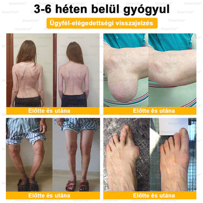 𝑺𝒕𝒂𝒘𝑽𝒊𝒕𝒂𝒍® Botoxot és Méhmérget Tartalmazó Regeneráló Krém Ízületekre és Csontokra | MOT (Magyar Ortopéd Társaság) által tanúsított termék
