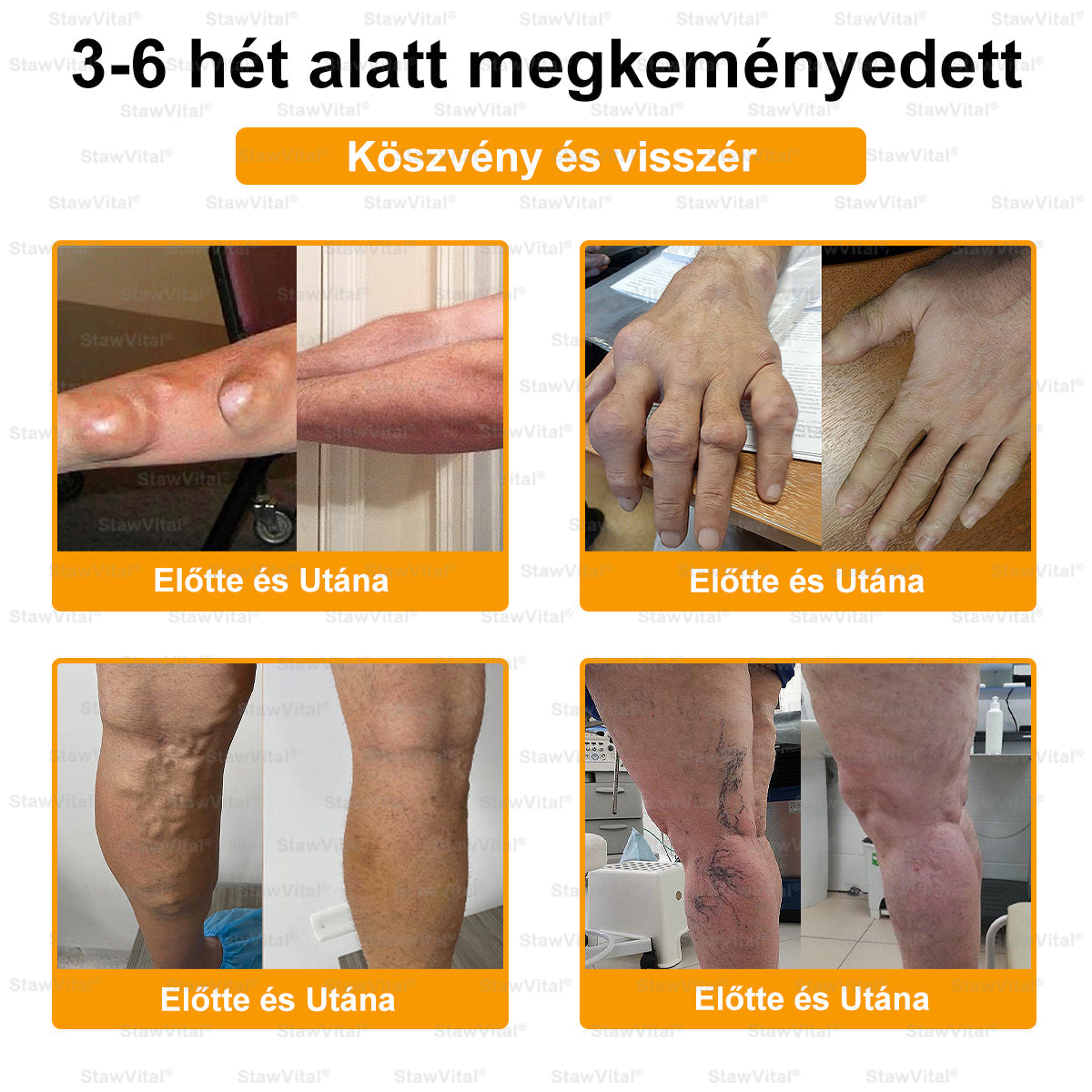 🟢𝑺𝒕𝒂𝒘𝑽𝒊𝒕𝒂𝒍® Botoxot és Méhmérget Tartalmazó Regeneráló Krém Ízületekre és Csontokra | MOT (Magyar Ortopéd Társaság) által tanúsított termék