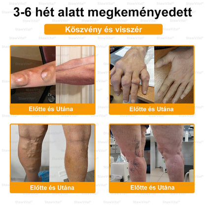 🟢𝑺𝒕𝒂𝒘𝑽𝒊𝒕𝒂𝒍® Botoxot és Méhmérget Tartalmazó Regeneráló Krém Ízületekre és Csontokra | MOT (Magyar Ortopéd Társaság) által tanúsított termék