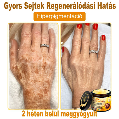 🌿Bőrgyógyász ajánlása ✨ ZödVita® Méhméreg Bőr Helyreállító Krém 🔥 Magyar fejlesztés, magyarországi gyártás és szállítás