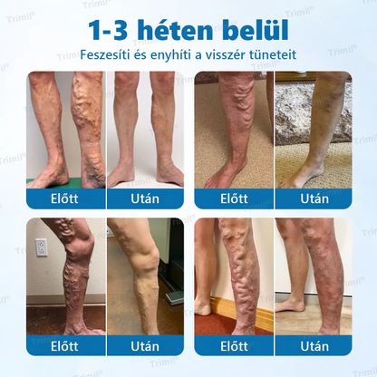 🔥🔥Trimil® VeinGuard Gyógynövényes Spray-✅ Klinikailag bizonyított, hogy mindössze 7 nap alatt megszünteti a visszereket!