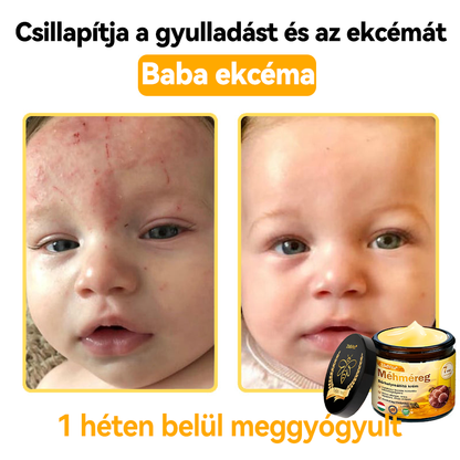 🔥🔥 Bőrgyógyász ajánlása ✨ ZödVita® Méhméreg Bőr Helyreállító Krém – Időskori purpura, ráncok és a bőr állapotának látványos javítása 💜 Magyar fejlesztés, magyarországi gyártás és szállítás