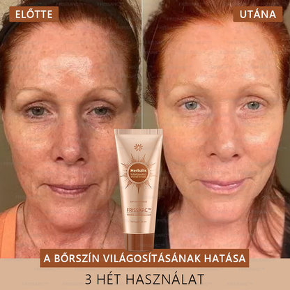 🎁𝐅𝐑𝐈𝐒𝐒𝐀𝐑𝐂™ Arcmaszk | Látható folthalványítás természetes összetevőkkel – szeplőkre, pigmentfoltokra, napkárosodásra🎁